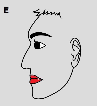 slanted or sloped forehead